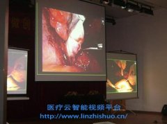 手術(shù)示教系統(tǒng)具體優(yōu)勢在哪里呢?